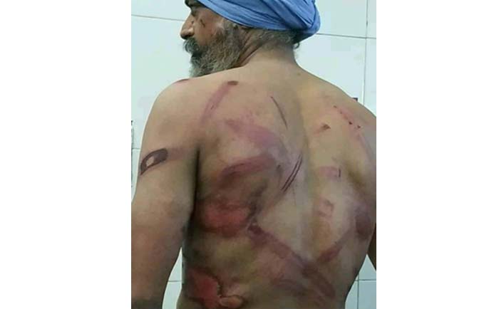 A farmer beaten. Photo from social media